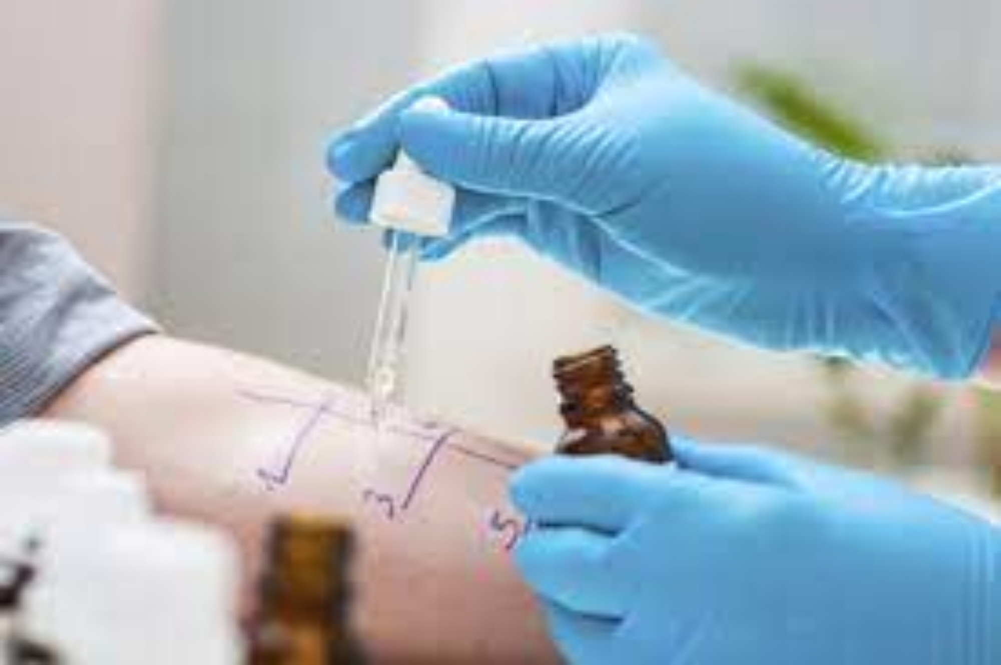 Bild für Kategorie Allergiediagnostik